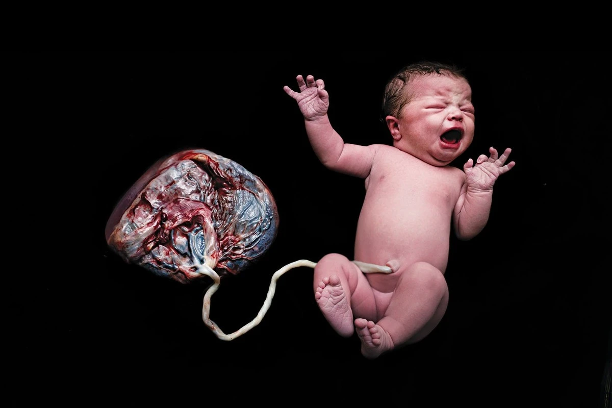 placentamozeskr-extra-1.webp Placenta może skrywać wczesne sygnały ryzyka schizofrenii - image 1