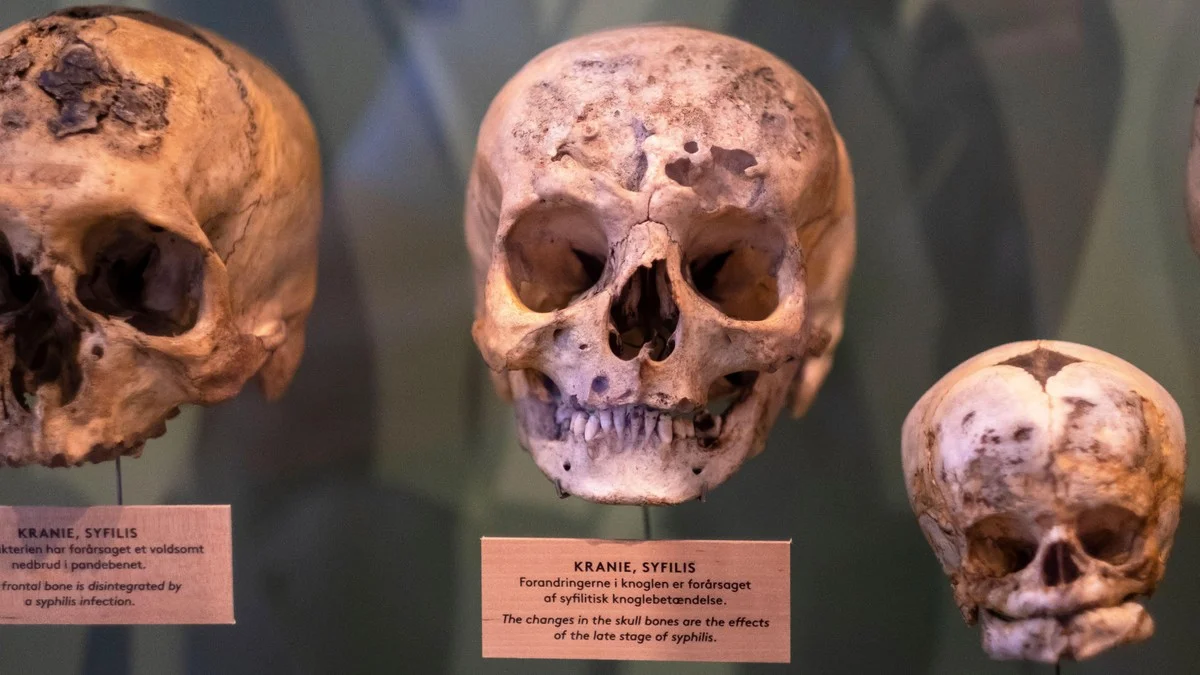 Domniemane korzenie kiły sięgają 5,5 tysiąca lat; genetyka odmienia historię - image 1