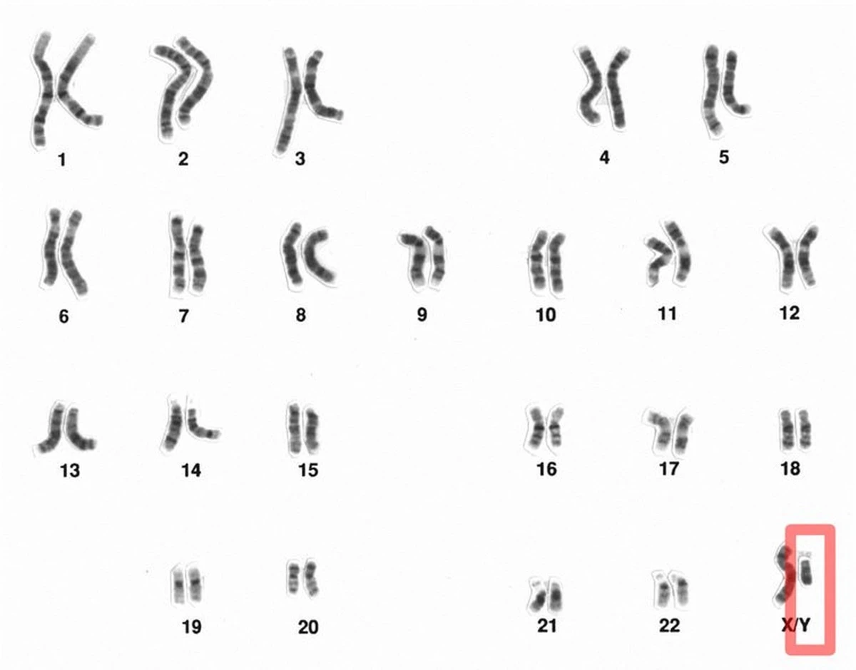 dlaczegomezczyz-extra-1.webp Dlaczego mężczyźni tracą chromosom Y z wiekiem i jaki to ma koszt dla zdrowia? - image 1