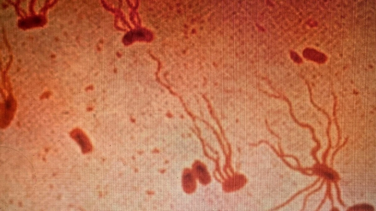 Starożytny zabójca zyskuje odporność na antybiotyki. Naukowcy biją na alarm: