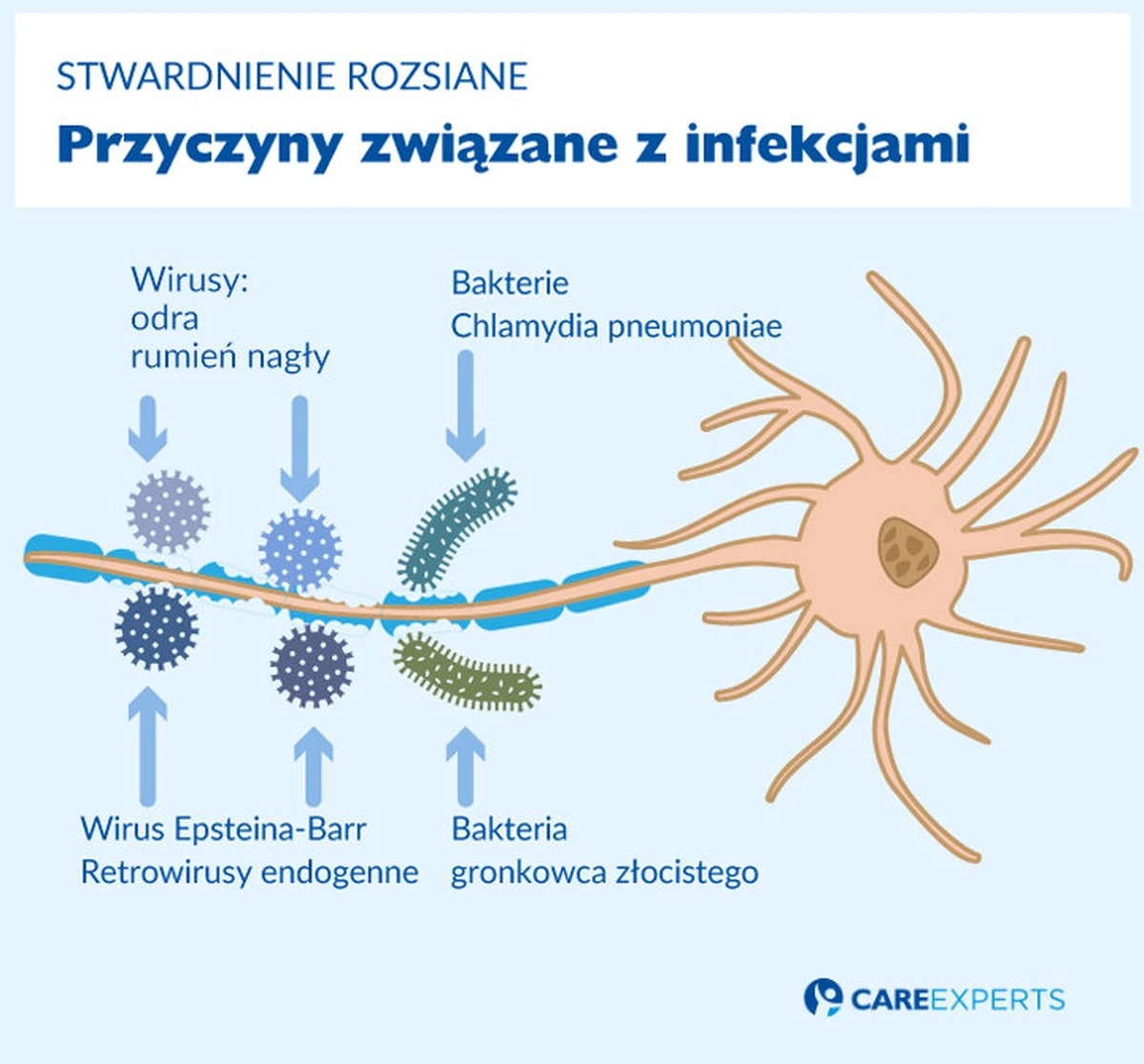 Ten powszechny wirus może być ukrytym sprawcą stwardnienia rozsianego. Nowe badania dają nadzieję. - image 1