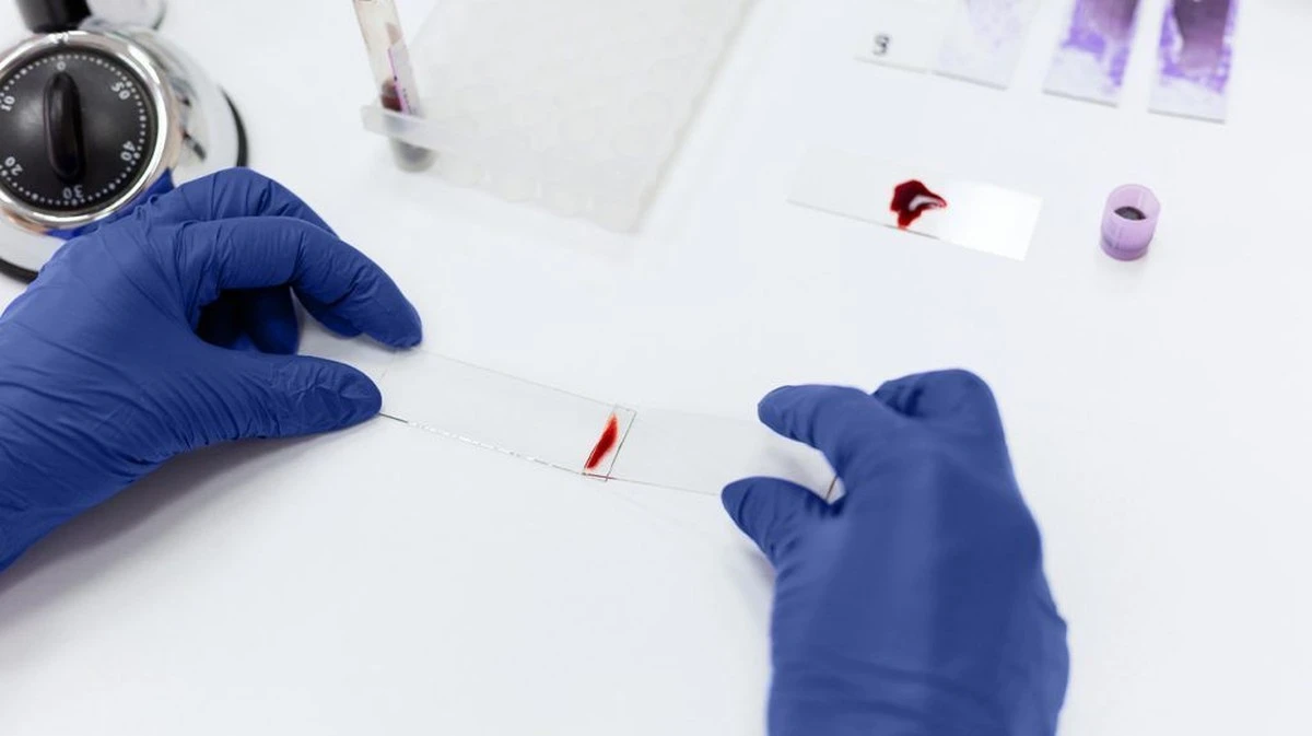 Prosty test krwi może przewidzieć ryzyko demencji u kobiet. Długoterminowe badania wykazują znaczną przewagę. - image 1