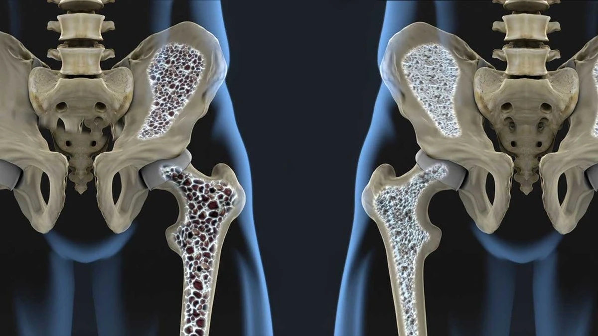 naukowcyodkryli-extra-1.webp Naukowcy odkryli przełom, który może odwrócić osteoporozę. To może zmienić twoje życie. - image 1
